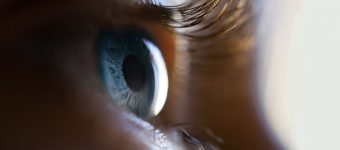 cómo prevenir el glaucoma ojo azul